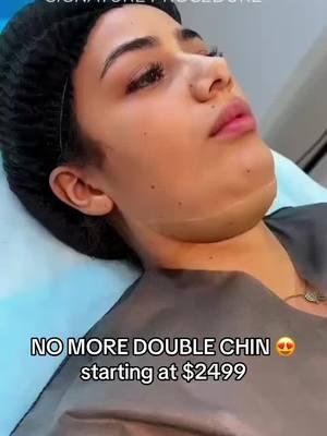 Say goodbye to double chin and hello to #snatchedface #fyp #tiktokviral #goalsplasticsurgery #drmiami #fypage #doublechinreduction #doublechin #beforeafter 