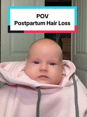 I am going bald… literally. #postpartum #postpartumhairloss #firsttimemom #ivfsuccess #babytiktok #momlifebelike #beatinginfertility 