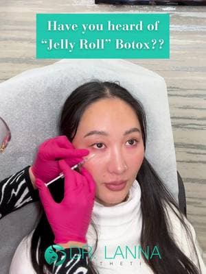 Bothered by under-eye creases when you smile? Let’s talk about Jelly Roll Botox! 👀✨ Those small, horizontal lines or bulges that appear under your eyes when you squint or smile are called jelly rolls—caused by the overactivity of the orbicularis oculi muscle. While they’re completely natural, they can sometimes make the eyes look tired or puffy. How does Jelly Roll Botox work? A small amount of Botox is carefully injected into the lower orbicularis oculi muscle, relaxing it just enough to smooth the area without affecting your natural expression. The result? A softer, more refreshed under-eye area with no surgery and minimal downtime.🙌 Results typically start appearing within 3-7 days and last 3-4 months—perfect for anyone looking to brighten and rejuvenate their eye area. ✨ Interested in trying it out? Call 646-422-7385 to book your consultation today! 📞 Drop a 👀 in the comments if you want to learn more, and don’t forget to follow @doctorlanna for more expert aesthetic insights! #jellyrollbotox #undereyebotox #jellyroll #botox #eyetreatment #undereyetreatment #aestheticinjector #medspanyc #aestheticinjections