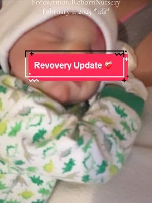 For anyone whose gone through gallbladder removal, please give me some helpful tips. #gallbladder #gallbladderremoved #gallstones #gallbladdersurgery #surgery #roadtorecovery #gallbladderprobs #reborndoll #levibybonniebrown #forevermorerebornnursery #리본돌 #bebereborn #리본돌계 #realisticdoll #surgeon #xycba #intubated #ugh 