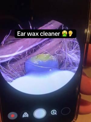 They selling out fast people.. hit that link and gets yours today from the TikTok shop.. #ear #earwaxremmoval #earcleanerwithcamera #tiktokmademebuyit #trannding 