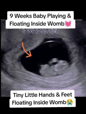 9 Weeks baby playing and floating inside womb during ultrasound scan #babyinsidebelly #babyinbelly #ultrasoundscan #babyultrasoundscan #babyinsidewomb #babyinside #babyultrasound👣💙 #babyultrasoundscan #babyultrasound🤰✔️ #babyultrasoundpost✨ #viraltiktokvideo #viralvideos 