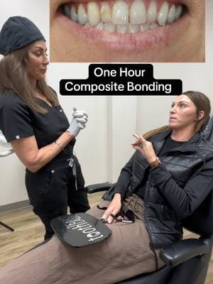 One hour composite bonding ...more affordable than porcelain veneers #fy #fyp #houstondentist #porcelainveneers #dental #teeth #compositebonding #bonding #affordable #gaps 