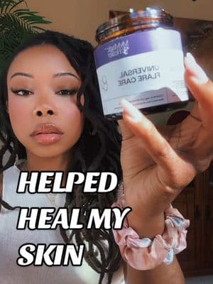 The reviews got me to try it, and I’m glad I did. 🙌🏾💗 #eczema #psoriasis #ointment #hs 