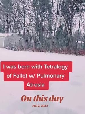 #onthisday #trowback #heartproblem #tetrologyoffallotwithpulmonaryedema #tetrologyoffallot 