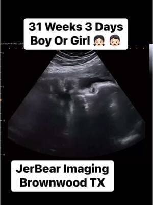 What Is Your Guess?  #jerbearimaging #31weekspregnant #girlorboy #ultrasoundnearme #pinkorblue #fyp #boyorgirlwedontknow #boyorgirl #genderultrasound #NewMomLife #UltrasoundCenter #heorshewhatwillitbe #browncounty www.jerbearimaging.com