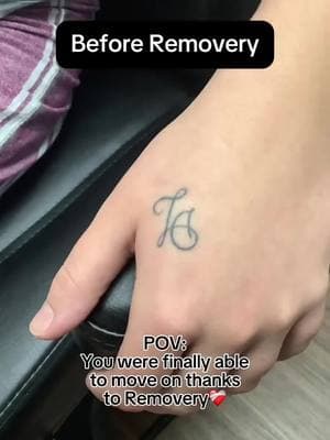 Tattoo Removal Results at Removery😍 This Valentine’s Day, say goodbye to an old relationship tattoo and enjoy $214 off complete tattoo removal. Click the link in our bio to learn more and schedule your FREE consultation today!🔗 #removery #tattooremoval #lasertattooremoval #tattoo #tattoos #fading #tattoofading #fadingtattoos #tattoocoverup #removetattoos #ustattooremoval #australiatattooremoval #canadatattooremoval #vdaydeals #valentinesdaydeals #vdayoffer #valentinesdaysavings #vdaysavings #removeon #breakupwithyourtattoo #relationshiptattoo #extattoo #exesnametattoo