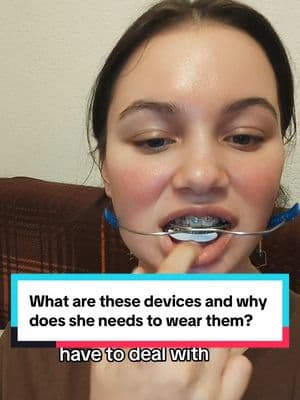 These devices are not as commonly used nowadays 👍 #braces #katytx #headgear #lipbumper