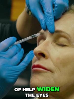 Say goodbye to fine lines and hello to flawless! Botox for the face, neck, and beyond—your beauty, your way! #AnthonyAesthetics #RefinedBeauty #TimelessElegance #BotoxExpert #BrowLiftMagic #YouthfulGlow #FacialRejuvenation #BeautyJourney #AestheticEnhancement #LookYourBest #NaturalResults #ConfidenceBoost #AestheticArtistry #AntiAgingSolutions #SkinRejuvenation #WrinkleFree #NonSurgicalLift #FacialContour #AgelessBeauty #BeautyTransformation #GlowUp #FacialAesthetics #BeautyRedefined #FreshLook #FacialSculpting #BeautyElevated #SelfCareMatters #AgeGracefully #SkinCareGoals #plasticsurgeon #facelift #faceliftspecialist #tampabay #stpete #stpeteflorida #anthonyaesthetics