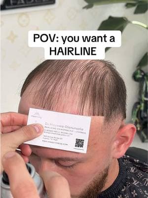 POV: hairline restored  - #Barbertok #barber #oddlysatisfying #katybarber #besthoustonbarber #losangelesbarber #labarber #miamibarber #houstonbarber #katytx #cypressbarber #dallasbarbers 