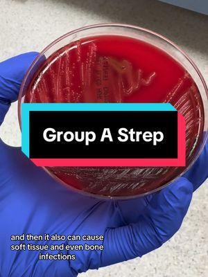 Replying to @bettyannduck girl you’re a superhero I’m so sorry!  #strep #strepthroat #lab #mlt #MLS #microbiologylab #microbiology #microbiologytiktok #medicallaboratorytechnician #medicaltechnologiststudent #ernurse #icunurse #medsurgenurse #nursing #medschool #healthcareworker #woundculture 