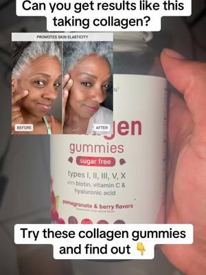 #CollagenGummies #MicroIngredients #HealthySkin #BeautyFromWithin #CollagenBoost #SkinCareSupplements #GlowUp #VeganCollagen #JointSupport #HealthyHair #CollagenForSkin #WellnessJourney #SupplementsThatWork #BeautySupplements #YouthfulSkin #NaturalSupplements #SkinHealth #BeautyEssentials #AntiAging #GlowFromWithin 