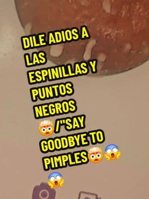 #espinillas #pielperfecta #cuidadodelapiel #puntosnegros#beautyhack #limpiezafacial #facial #viralproduct#acne #poros#skin #blackhead 