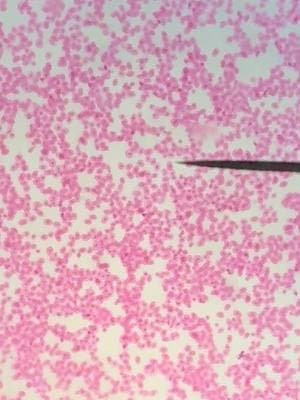 Animal vs Plant cells 🐀🌲 #eurayotic #nucleus #cellwall #cells #science #fyp