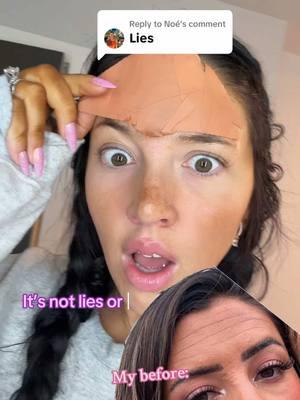 Replying to @Noé it’s not lies! It’s called consistency with @Frownies 😍💖🙌🏻 skip the Botox and start frownies.. use code LAURAELLE for 10% off your purchases!!  #frownies #frowniesfacialpatches #botoxalternatives #frownieswrinklepatch #frowniesbeforeandafter #insaneresults 