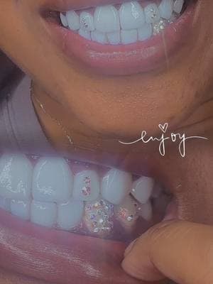 We Understood The Assignment 🌟⭐️ Let Us Ice You Out 💎💎 We Love What We Do ‼️Carlie Crystalz Adding Style To Your Smile🔥 High Quality Products Only‼️ No Drilling No Pain No Damage To Your Enamel ‼️ VS DIAMONDS Should Last 1+ Year With Proper Care And Removed With No Hassle ‼️ Why Wait ‼️ #ToothGemz #CarliezCrystalz #memphiscompositeveneers #thingstodoinmemphis #memphistoothgems 