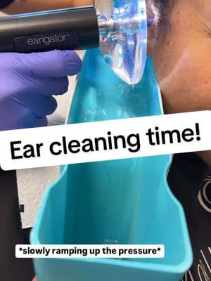 Successful ear cleaning using the @earigator #earwax #wax #earcleaning 