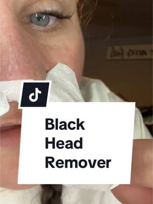 The real blackhead remover see it right here in real time get that dirt out of your pores. Keep your blackheads away this actually works. #blackheadextraction #blackheadremover #blackheadremovals #lanbena #lanbenaproducts #lanbenaskincare #fypシ゚viral #foryourpage #fypviraltiktok🖤シ゚☆♡ #fyppppppppppppppppppppppp #skin #tiktokshoploveatfirstfind #lovelanguage #relatable #pores #porestrip 