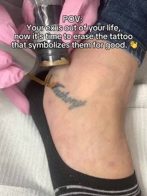 👋 Your ex is gone, and the tattoo should be too! It’s time for a fresh start—save $214 on complete tattoo removal for old relationship tattoos until 2/15!❤️‍🩹 Eligible tattoos: rings, names (including initials), infinity signs, symbolic dates, kings/queens, and hearts. Click the link in our bio to find a studio and schedule your FREE consultation today!🔗 #removery #tattooremoval #lasertattooremoval #tattoo #tattoos #fading #tattoofading #fadingtattoos #tattoocoverup #removetattoos #ustattooremoval #australiatattooremoval #canadatattooremoval #vdaydeals #valentinesdaydeals #vdayoffer #valentinesdaysavings #vdaysavings #removeon #breakupwithyourtattoo #relationshiptattoo #extattoo #exesnametattoo