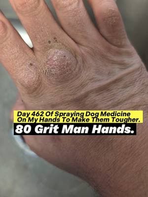 Day 462 Of Spraying Dog Medicine On My Hands To Make Them Tougher. 80 Grit Man Hands. #roughhands #dogmedicine #ironfist #martialarts #sandpaper #boxing #badmintontraining #toughhandspray #dogspray #softhands #bluecollar #asmr #oddlysatisfying #ballisticdummy #microfibertowel #skincareroutine #fistofthedogmedicine #fyp 