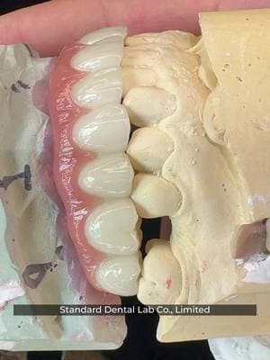 all on 4 hybrid titanium screw retained dental implant crown from sdl dental lab zirconia bridge #hybrid #from #allon4 #zirconiabridge #retained #crown #dentalimplant #sdl #titaniumscrew