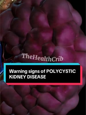 Warning signs of POLYCYSTIC KIDNEY DISEASE  #polycystickidneydisease#kidneydisease#kidneyfailure#kidneyfailureawareness 