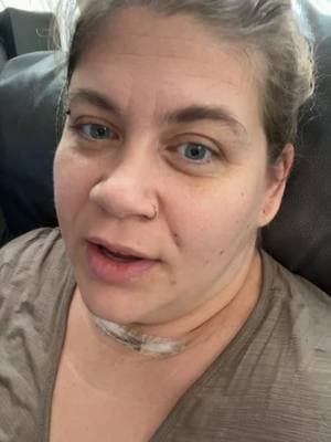 4 days since surgery update! #swelling #totalthyroidectomy #thyca #papillarythyroidcarcinoma #pain #phlegm 