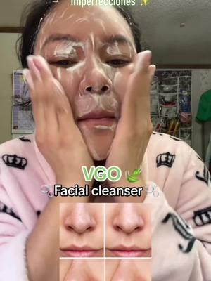 Limpiador facial efectivo y accesible Facial cleanser of double care and effets, 100% recomendado INVIERTE EN ALGO #facialcleanser #vgo #sanvalentin #diadesanvalentin #gift  #skincare #routine #clean #limpiadorfacial #VGO #vgofacialcleanser