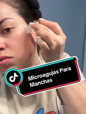 Micro Agujas#tratamientos #manchas #pielmadura #videos #Skin #sayrebytips #manchas 