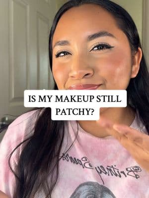 Replying to @divinelyyours I’d say is looking better but it’s not looking like when I didn’t have this problem 😭. I’ll keep trying different things tho.  #skincare #makeup #makeupgirl #patchymakeup #makeup #dryskin #makeupgirly #latinacontentcreator #latinacontentcreator #fyppppppppppppppppppppppp #imjustagirl #skincaregirly #makeuptips #skinprep 