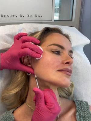 Sharp, snatched, and sexy- let’s touch up her jawline! 😌 #jawlinefiller #jawlinegoals #beautybydrkay #fypシ 