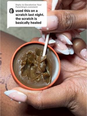 Replying to @Decolonize Your Parenting I keep this prid salve in my medicine cabinet #prid #drawingsalve #salve #splinterremoval #cysticacne #pridsalvecysticacne #pridsalve #boilrelief #skincare #skintips #painrelief #painrelief #cuts #ingrowns #ingrownhairs #ingrownremoval #ingrownrelief #boil #boilremoval 