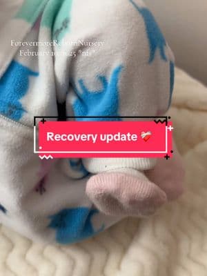 #recoveryupdate #gallbladder #gallstones #gallbladdersurgery #gallbladderremoved #surgery #giannaandgiulia #chenzadolls #diprosopus #conjoinedtwins #fakemilkforfakebabies #reborndoll #forevermorerebornnursery #doll #리본돌계 #therapydoll #리본돌 #bebe #muneca #rebornartdoll #fakemilk #winterboots #taylorswift #eilish 