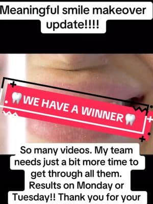 #stitch with @That_DiQuattro_Dentist 👈 go there #freesmilemakeover #dentures #duenturegang #winner #fyp #foryoupage #fypage #freesmilemakeover #free #newsmile #smile #makeover #giveaway