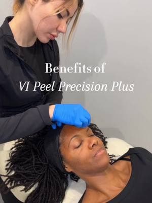 Struggling with breakouts and stubborn acne scars? VI Peel Purify with Precision Plus is your solution! ✨ This powerful peel fights acne, reduces oil, and fades dark spots so you can feel confident in your skin again. ✔ Clears clogged pores & breakouts ✔ Fades acne scars & dark spots ✔ Controls oil & prevents future breakouts ………………………………………….. 📱Feel free to contact us for more info or to schedule your treatment! ……………………………………………⠀⠀ ☎️ Phone: 818-789-5500 🌍Website: www.zcosmetichealth.com 📩 Appointments: info@zcosmetichealth.com 📍Location: Sherman Oaks, CA …………………………………………… 🧴Shop Zadeh MD Skin: www.shopzadehmdskin.com …………………………………………… For more before and after photos, information on my techniques, and verified reviews from patients checkout 👤Facebook/IG: @zcosmetichealth ⏰ TikTok: @zcosmetichealth ▶️ YouTube: @zcosmetichealth 📬 info@zcosmetichealth.com #VIpeel #AcneSolutions #ClearSkinJourney #acnejourney #acnescars #acnetips #acneskincare #acnefree #acnefighter #acneproneskin #skincareforall#AcneSolutions 