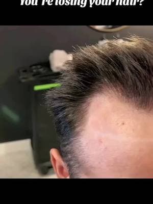 Receding hairline? We’ve got the solution. 😮 Search for Tp1911 via my bio link🔥#hair #hairtok #haircut #hairsystem #hairstyle #toupee #hairreplacement #hairunit #menshair #barberlife #salon #menswigs #wigsformen