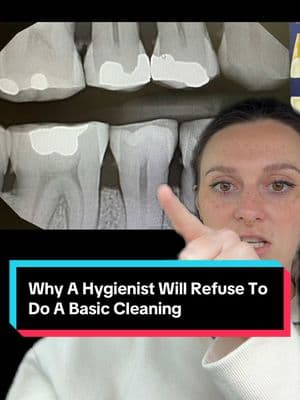 I already know I’m going to get comments saying “well it’s better than doing nothing”… My answer to that is: I AM DOING NOTHING. I would be doing nothing for your health, nothing for your teeth, and nothing for your gums. Patients who only want the “basic” or “regular” cleaning when they have active periodontal disease are basically asking me to leave the infection in their mouth and just clean around it… make that make sense. AND FOR THE PEOPLE WHO SAY: “I can’t afford it”. GO TO A DENTAL HYGIENE SCHOOL! It’s either free or SUPER CHEAP, and it’s the best cleaning you’ll ever get because multiple professors are checking behind the students to make sure it’s done correctly. #fyp #dental #dentistry #deepcleaning #education #dentalhygienist #dentist #viral #trend #trending #fypシ #fypシ゚viral #LearnOnTikTok #medical #health #healthy #CleanTok #clean #teeth#greenscreen #longervideos #long 