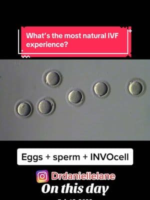 #onthisday #invocell #ivfjourney #getpregnant #naturalivf #fyp Some people truly feel that this is a good approach for them.  The #embryos stay with you, there is natural #insemination and typically no #embryobiopsy .  #pregnancyrates are ~50% in a carefully selected population. #lanefertility #lanefertilityinstitute 