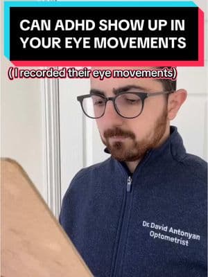 Have you ever wondered if your eyes reveal signs of ADHD? 👀✨ At Vivid Visions Optometry, Inc., we use a one-of-a-kind eye-tracking test that records your eye movements in real time. Many patients are shocked when we can tell they’ve been diagnosed with ADHD—just by analyzing how their eyes move! ADHD isn’t just about focus; it often involves difficulty controlling eye movements, leading to visual strain, reading struggles, and even headaches. With advanced eye-tracking technology, we pinpoint these subtle vision issues and provide personalized solutions like prism glasses and vision therapy to help your brain process visual information more efficiently. Think your eyes might be telling a different story? Book an evaluation today: www.vividvisionsoptometry.com/appointments #ADHD #VisionAndFocus #BinocularVisionDysfunction #PrismGlasses #VisionTherapy #EyeTracking #VividVisionsOptometry #NeuroVisualCare #ADHDTesting #ValenciaCA #BVD #HeadacheRelief #onthisday 