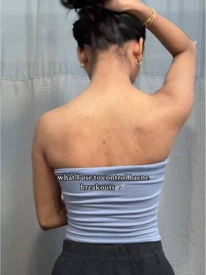 just in time to wear open back tops this summer @Tower 28 Beauty #bacne #hyperpigmentation #bacnescars #acneproneskin #acnespray #summerskincare #bodyacne #acnehack #faceandbody #topicals #skinlightening #skincare #trendingproducts 