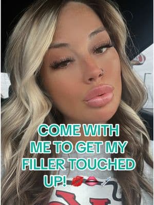 I am OBSESSED with my injector! She’s beyond amazing!!! @@auntikoko at @La Boussole Medical Spa 🩵 #filler #lipfiller #botox #lipflip #fillercheck #comewithme #beauty #aesthetics #lipinspo #lipinjections 