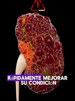 #riñón #limpieza #kidneyfailure #kidneystone #kidney #salud #kidneycancer #kidneydetox #fyp 