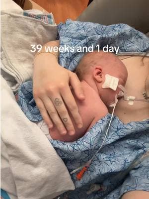 Might as well finish the video right? What went from a prefect pregnancy changed when they didn’t catch my uterus rupturing in time, it only takes a matter of a few seconds for your whole life to be changed. My baby now has severe brain damage. #uterinerupturesurvivor #uterineruptureawareness #hie #cerebralpalsyawareness #nicumom #nicubaby #nicujourney #trauma #nicustrong #braindamage #pregnancy #birthtraumaawareness 