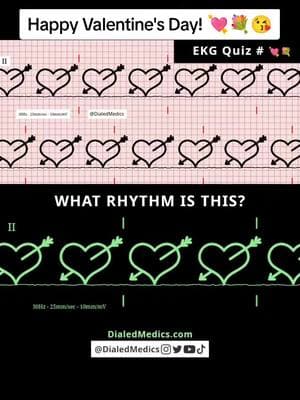 💘💐😘 Happy Valentine's Day! All #EKG recordings are from the EKG rhythm generator on my website (LII rhythms only for now, 12Ls are in beta and coming soon), be sure to check it out for more software generated #ECG practice! (Link in bio.) #EMS #ACLS #emstok #paramedic #paramedicsoftiktok #medic #medicsoftiktok #flightmedic #criticalcareparamedic #paramedicstudent #paramedicschool #emta #emtb #emt #emtlife #emtsoftiktok #emtstudent #emtschool #firstresponders #NREMT #nurse #nursesoftiktok #RN #nursingstudent #nursingschool #flightnurse #criticalcarenurse #emergencynurse #NCLEX #nclexrn #nclexprep #doctor #doctorsoftiktok #medicalstudent #USMLE #emergencymedicine #criticalcare #cardiology #FOAMED #ValentinesDay 