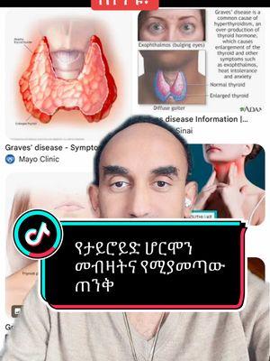 #hyperthyroidism #drsoftiktok #ethiopian_tik_tok🇪🇹 #habeshatiktok #eritreantiktok🇪🇷 #usatiktok🇺🇸 #dubai🇦🇪 #saudiarabia🇸🇦 #europeantiktokviral🇪🇺 #australia🇦🇺 #canada🇨🇦 #ሼር_በማድረግ_ያጋሩ 