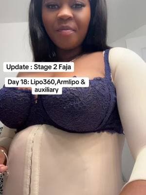 Stage 2 Faja:Lipo 360, arm lipo and auxiliary. hey y’all, I am feeling much better. I am overall just sore no pain. Today is my mother‘s birthday and I actually wanted to attempt to get dressed. I currently have on lipo foam , ab board, backboard, and arm straps for my arms. ##bbl##y##lip360##lipoarm##armlipo##liposuction##backlift##liporecovery##surgerytiktok##postopcare