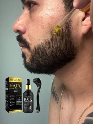 Este nuevo #serum para la barba contiene minoxidil al 5% más biotin, con esta fórmula obtuve crecimiento y densidad #beard #beardgrowth #serum #hairlost #hairgrowth #beardmen #beardlook #barba #productosparahombres #productosparaelcabello #hombres #beardtok #crecimientodelcabello 