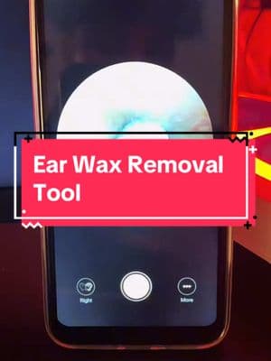 Say goodbye to earwax buildup! This tool works wonders! 😍 #earcare #TTSDelightNow #TikTokShopDeals