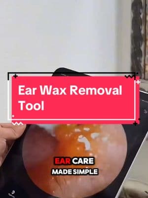 Cleaning your ears the RIGHT way! 👂🔥 #earhealth #earwaxremoval #TikTokShopJumpstartSale