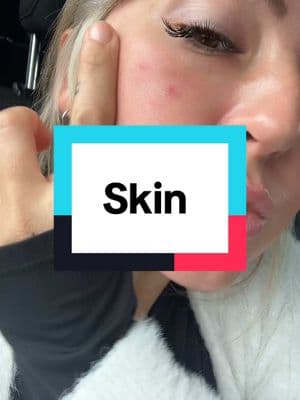 Tell me what yall think these are ! #skincondition #skinspots #skin #sunexposure #39yearsold #spotsonskin #skinstok ##whatarethese #help #tiktokgoogle 